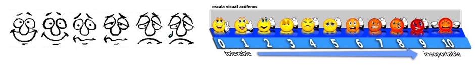 escalas analogicas